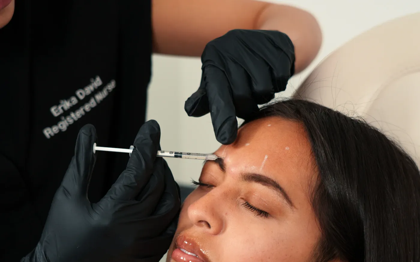 Injection esthétique réalisée par un praticien